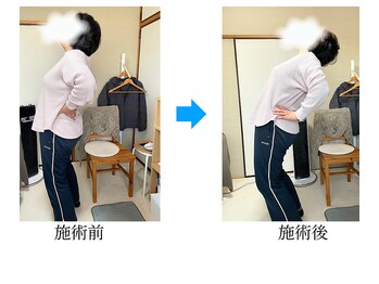 さくらの整体院/60代女性腰痛でお悩み