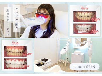 ティアナ 徳島店(Tiana)/ 綺麗な歯が私のモチベーション