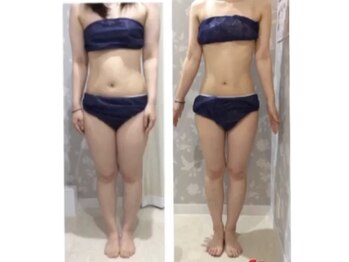 カラット(CARAT)/お客様のビフォーアフター一例