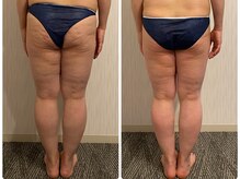 エステサロン暁/ボディケア～2～