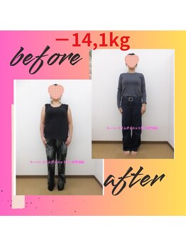スーパースリムダイエット茅ヶ崎 茅ヶ崎整体院/4ヵ月－14,1ｋｇ減ダイエット♪