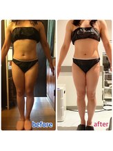 アンリール 苫小牧店(ANRIRE)/ボディー施術のお客様です