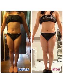 アンリール 苫小牧店(ANRIRE)/ボディー施術のお客様です