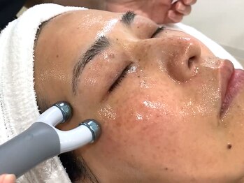 ニコン(nicon)の写真/ハリツヤ肌はシェービングで◎乾燥肌にお悩みの方！青クマ小ジワ改善ヒアルロン酸導入＆シェービングエステ