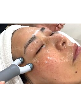 ホウレイ線・たるみ改善！予防ケア