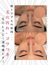 アンフィア(Anfia)/