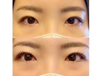 グロウビューティー(grow beauty)/