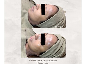 エスポワールカルド(Espoir caldo)/