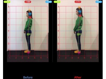 ケアルーム 湘南台(CARE room)/施術効果写真☆(before after)