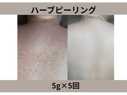 ウィズサロン(withサロン)の写真