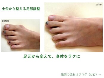 サロンラグナ(Salon Laguna)の写真/足指やツメの変化、足裏のタコ、見過ごしていませんか？長年の不調は足が関係しているかも。