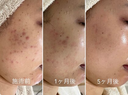 シェノン 赤坂大濠店の写真