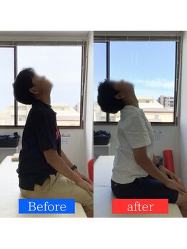 ナオル整体 神戸住吉院(NAORU整体)/30代女性【慢性肩こり・首こり】