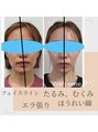 パルフェ(THE Parfait) 左右のバランス,エラ張り,むくみ,フェイスラインなどのお悩みも