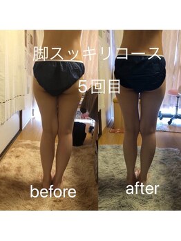 ナナラ(nanala)/脚スッキリコース