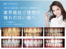 ホワイトニングショップ 会津若松店