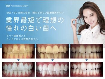 ホワイトニングショップ 会津若松店