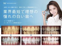 ホワイトニングショップ 会津若松店