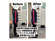 アンティオール 札幌店/30代女性　姿勢矯正/ブライダル