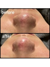 クリアボックス(Clear box)/