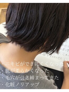 ソワ 吉塚店(soi)/繰り返しニキビケア!