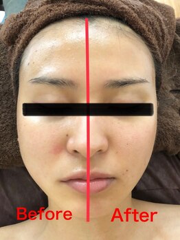 ミント(M’int)/メリハリ、立体感のあるお顔