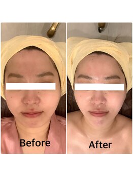 スペチアーレ 夙川/小顔と美肌で美顔革命★