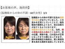 江坂回復アップラボ/お客様の声、施術例