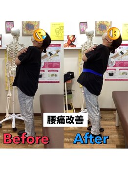 ヒデ整体院(Hide整体院)/猫背矯正骨盤矯正B/A肩こり腰痛