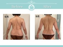 美人バスト 犬山店/【背中引き締め】症例♪