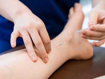 フィット鍼灸整骨院 ぶばい院の写真/《スタッフ国家資格者》「春を迎える前に、体をもっと良くする」 買い物ついでにホッと温まる温活鍼灸も◎