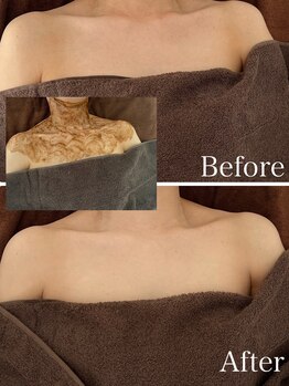 ベルエクラ(Bel Eclat)/ネックデコルテケア/毛穴・シミ