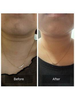 オフモード(OffMode)/首シワにもアプローチ！