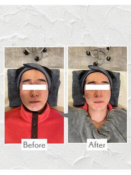 リノ ショウナン(LINO SHONAN)/男性にもおすすめ!