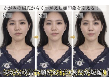 サロンチオリ 烏丸(Salon Chiori)/歪み左右差は骨盤と口内から改善