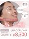 サロンドボーテアリス (Salon de beaute ALICE)の写真/【浦和エリア希少!】韓国で話題の施術を当店で！ララピール初回￥8300しわ・たるみ改善、毛穴の開きケアに!