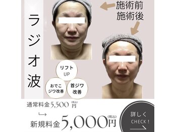 きれい塾 恵比寿/ラジオ波