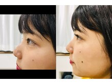 ルピナス(Lupinus)/下がりまつ毛の方に☆