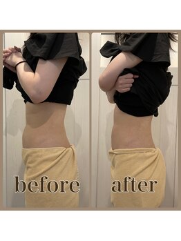 ファビー(Fabby)/マグフォース1回のビフォアフ