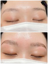 リコ(Lico)/ハリウッドブロウリフト