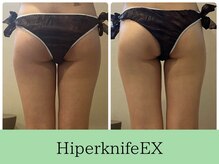 ソルニスデュオ(Solnis.-duo-)/痩身/酵素浴/毛穴/よもぎ蒸し