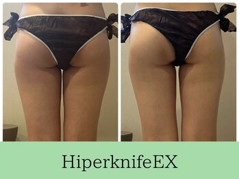 ソルニスデュオ(Solnis.-duo-)/痩身/酵素浴/毛穴/よもぎ蒸し