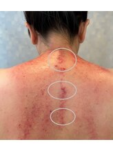 手もみ屋/施術後