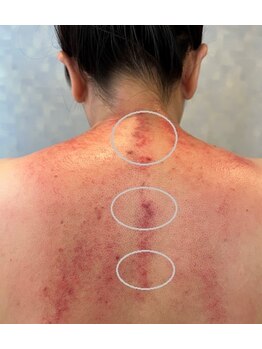 手もみ屋/施術後