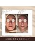 大人の肌悩みに★ヒト幹細胞導入でハリ・弾力UP　￥22000