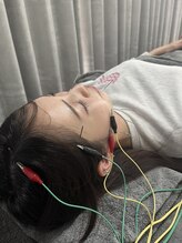 リノン/美容鍼で血流アップし脱！疲れ顔