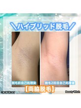 ビューティ ウィッチ(Beauty Witch)/