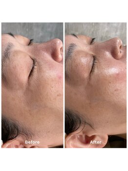 ゆりの花/オールハンドフェイシャル70分