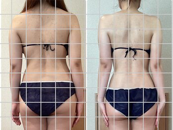 サロンドルフレ(salon de Reflet)の写真/【ブライダル/春に向けて◎】美背中~二の腕のシルエットに結果出し★すっきり引き締め美BODYへ導きます!