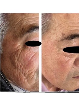 ココチ(KOKOCHI)/プレミアムインジェクション